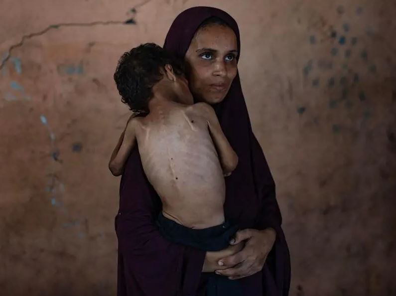 La fame come arma da guerra